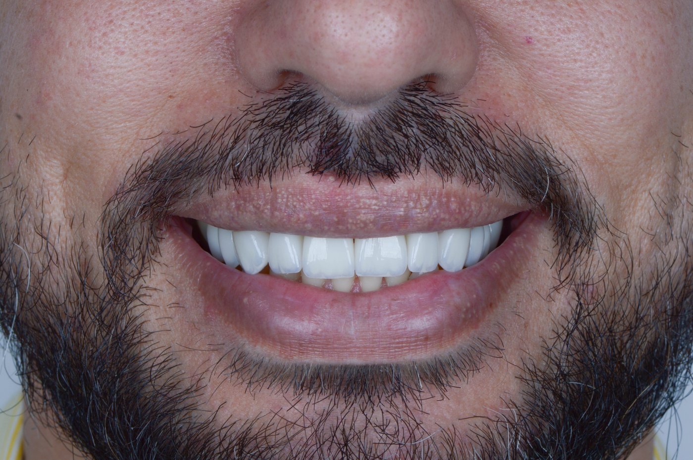 Periodontia
